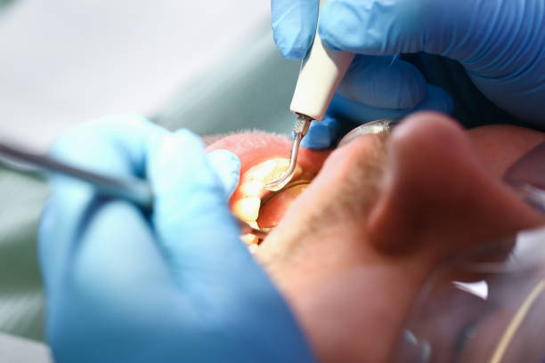 Best Emergency Cosmetic Dentistry in Marion, SC